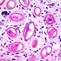 �����������������C���[�W