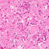 �����������������C���[�W